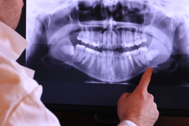Best Emergency Wisdom Teeth Removal in Flying Hills, PA
