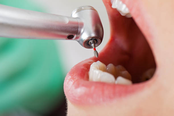 Best Walk-In Emergency Dentist in Flying Hills, PA
